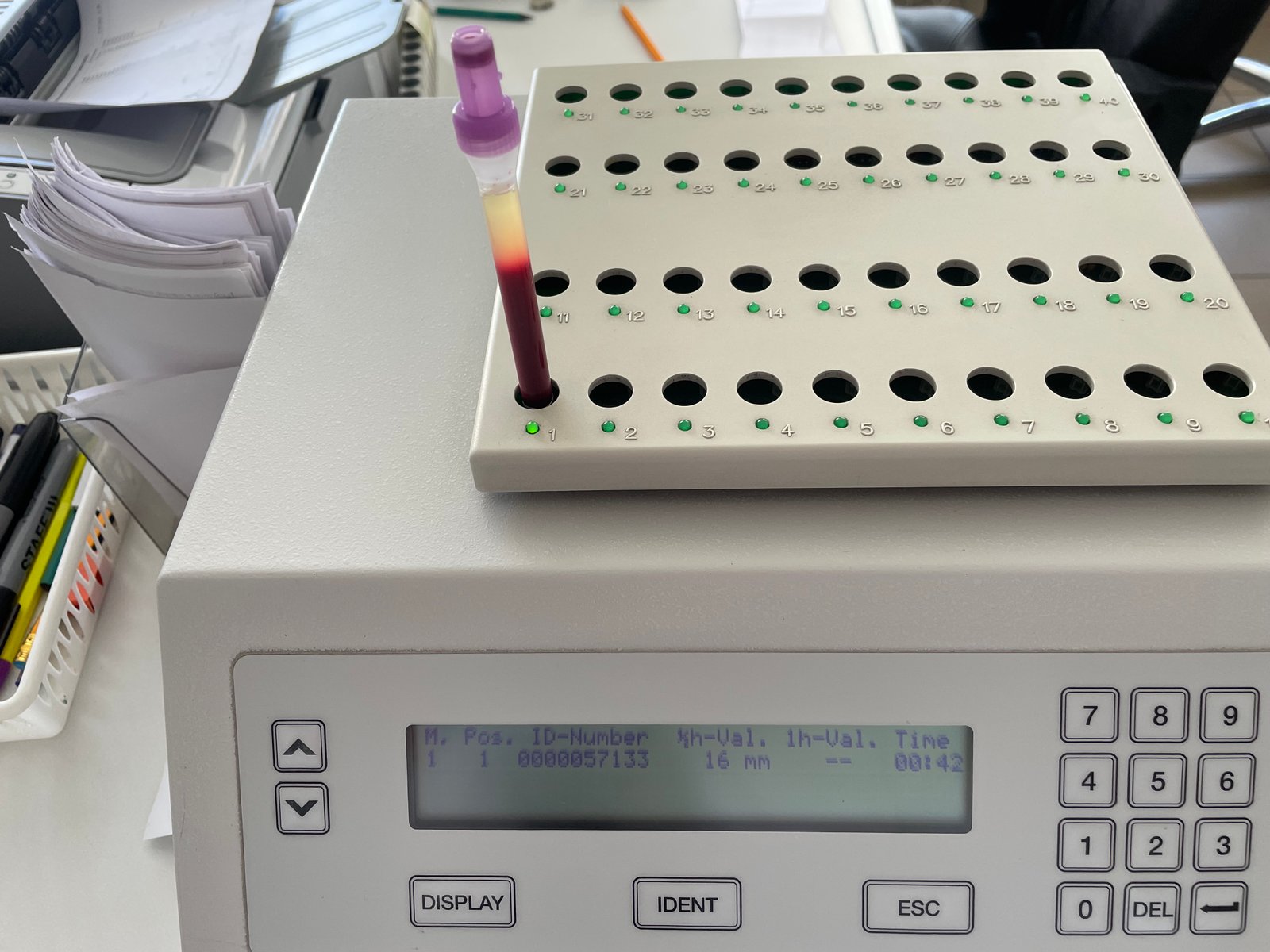Laboratory fit-out Dubai - automated analyser on a laboratory bench, the equipment schedule that must be locked before Sheryan submission